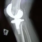 Iceland to become the next hotspot for medical tourism and health care item-thumbnail