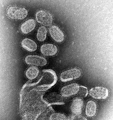 Health experts: Norway has most intense flu transmission in Europe item-thumbnail