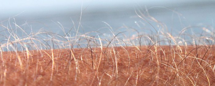 Underarm hair Facebook post causes controversy in Sweden