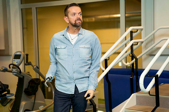 Icelandic man becomes first in world to receive double arm and shoulder transplant